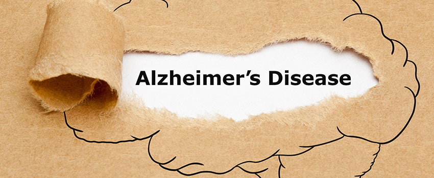 How Common Is Alzheimer’s?